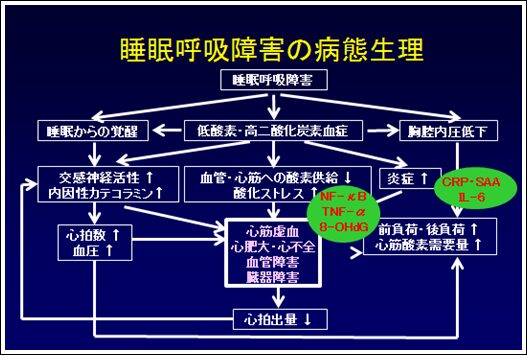 睡眠呼吸障害の病態生理